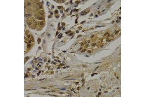 Immunohistochemistry of paraffin-embedded human normal stomach using UMPS antibody at dilution of 1:200 (400x lens). (UMPS Antikörper)