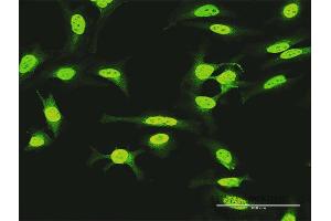 Immunofluorescence of purified MaxPab antibody to KIAA1967 on HeLa cell. (CCAR2 Antikörper  (AA 1-923))