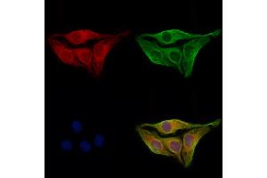 ABIN6264259 and ABIN6273065 staining Hela cells by IF/ICC. (PKLR Antikörper  (Internal Region))