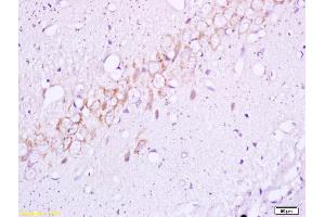 Formalin-fixed and paraffin embedded rat brain tissue labeled with Anti BETA(TYR1345) Polyclonal Antibody,Unconjugated (ABIN747128) at 1:200 followed by conjugation to the secondary antibody and DAB staining. (ISR-beta Antikörper  (pTyr1355))