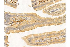 ABIN7094769 and ABIN7098820 at 1/100 staining Mouse stomach tissue by IHC-P. (PRMT3 Antikörper  (Internal Region))