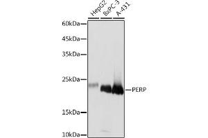 Western blot analysis of extracts of various cell lines, using PERP Rabbit mAb (ABIN7270861) at 1:1000 dilution. (PERP Antikörper)