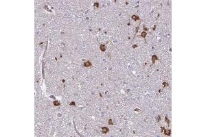 Immunohistochemical staining (Formalin-fixed paraffin-embedded sections) of human cerebral cortex with FMR1 polyclonal antibody  shows strong cytoplasmic positivity in neuronal cells at 1:200 - 1:500 dilution.