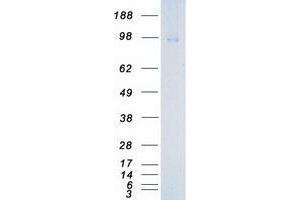 Western Blotting (WB) image for Neurotrophic tyrosine Kinase, Receptor, Type 3 (NTRK3) (Transcript Variant 1) protein (Myc-DYKDDDDK Tag) (ABIN2734342)