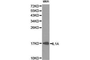 Western Blotting (WB) image for anti-Interleukin 1 alpha (IL1A) antibody (ABIN1873200) (IL1A Antikörper)