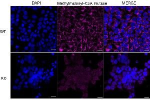 Immunocytochemical staining of HeLa cells using Methylmalonyl-CoA mutase antibody (ABIN7799396), 1:1,000), Top panel: wild-type (WT), Bottom panal: Methylmalonyl-CoA mutase shRNA knockdown (KD). (Rekombinanter MUT Antikörper)