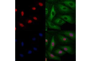 ABIN6263454 and ABIN6269077 staining  cells by IF/ICC. (c-MYC Antikörper  (N-Term))
