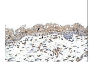 RNF25 antibody was used for immunohistochemistry at a concentration of 4-8 ug/ml.