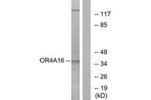 Western blot analysis of extracts from COLO cells, using OR4A16 Antibody. (OR4A16 Antikörper  (AA 261-310))