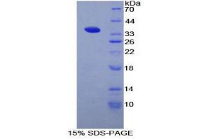 SDS-PAGE (SDS) image for CD1d Molecule (CD1D) (AA 32-302) protein (His tag) (ABIN1879114)