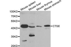 Western blot analysis of extracts of various cell lines, using CTSE antibody. (Cathepsin E Antikörper)