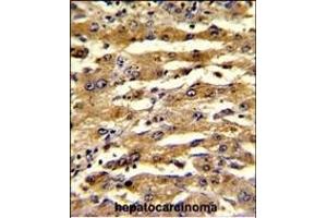 Immunohistochemistry (Paraffin-embedded Sections) (IHC (p)) image for anti-Fatty Acid Binding Protein 3, Muscle and Heart (FABP3) (AA 1-30), (N-Term) antibody (ABIN390431)