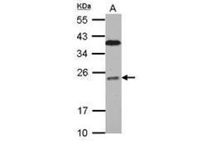 Image no. 2 for anti-B-Cell CLL/lymphoma 7C (BCL7C) (AA 1-215) antibody (ABIN1496855) (BCL7C Antikörper  (AA 1-215))