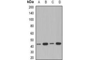 Western blot analysis of ACAA1 expression in A549 (A), Jurkat (B), mouse kidney (C), rat liver (D) whole cell lysates.