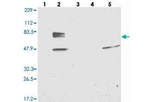 Western blot analysis of Lane 1: RT-4, Lane 2: U-251 MG, Lane 3: Human Plasma, Lane 4: Liver, Lane 5: Tonsil with EYA4 polyclonal antibody . (EYA4 Antikörper)