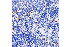 Immunohistochemistry of paraffin-embedded mouse spleen using ANXA1 antibody. (Annexin a1 Antikörper  (AA 1-346))