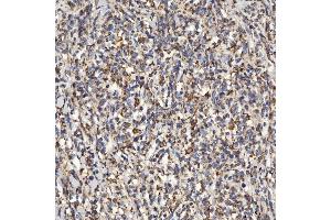 IHC analysis of SLC25A24 using anti-SLC25A24 antibody (ABIN7599228).