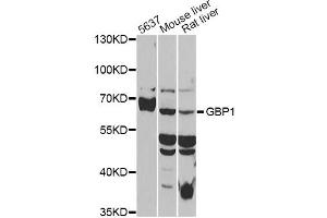 Western blot analysis of extracts of various cell lines, using GBP1 antibody (ABIN6293142) at 1:1000 dilution. (GBP1 Antikörper)