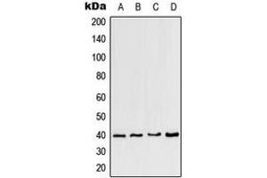 Western blot analysis of CCRL2 expression in HeLa (A), mouse heart (B), mouse brain (C), rat brain (D) whole cell lysates. (CCRL2 Antikörper  (Center))