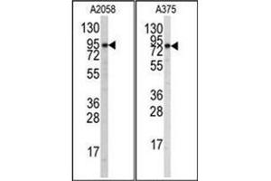 Western blot analysis of anti-Autophagy ATG9A Antibody (C-term) in A2058 and A375 cell line lysates (35ug/lane). (ATG9A Antikörper  (C-Term))