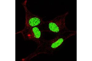 Fluorescent confocal image of SY5Y cells stained with phospho- LIN28-  antibody. (LIN28A Antikörper  (pSer134))