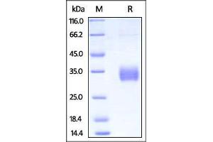 Biotinylated Human FcGR2A / CD32a (H131) on SDS-PAGE under reducing (R) condition. (FCGR2A Protein (AA 36-218) (His tag,AVI tag,Biotin))