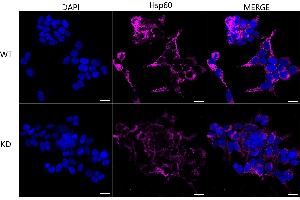 Immunocytochemical staining of HeLa cells using Hsp60 antibody (ABIN7798847), 1:1,000), Top panel: wild-type (WT), Bottom panal: Hsp60 shRNA knockdown (KD).