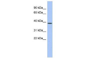 WB Suggested Anti-EN1 Antibody Titration:  0. (EN1 Antikörper  (Middle Region))