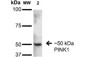 Western Blot analysis of Rat Brain showing detection of ~50 kDa PINK1 protein using Mouse Anti-PINK1 Monoclonal Antibody, Clone S4-15 . (PINK1 Antikörper  (AA 112-496))