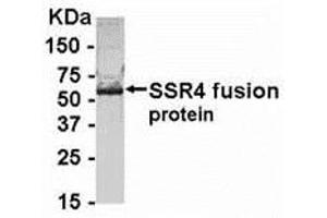 Western Blotting (WB) image for anti-Signal Sequence Receptor, delta (SSR4) (AA 61-130) antibody (ABIN2468174) (SSR4 Antikörper  (AA 61-130))