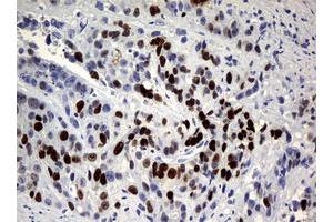 Image no. 3 for anti-Antigen Identified By Monoclonal Antibody Ki-67 (MKI67) (AA 1160-1493) antibody (ABIN1490857) (Ki-67 Antikörper  (AA 1160-1493))