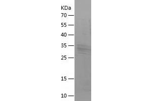 Western Blotting (WB) image for Brain Natriuretic Peptide (BNP) (AA 27-121) protein (His-IF2DI Tag) (ABIN7122022) (BNP Protein (AA 27-121) (His-IF2DI Tag))