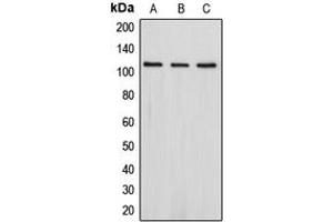Western blot analysis of PSD93 expression in Jurkat (A), SHSY5Y (B), HepG2 (C) whole cell lysates.