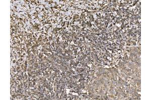 IHC analysis of KIF2A using anti-KIF2A antibody (ABIN7600510). (KIF2A Antikörper  (AA 2-706))