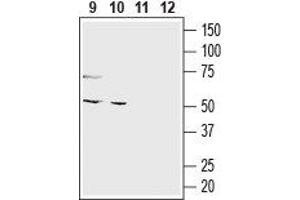 Western blot analysis of mouse colon (lanes 9 and 11) and human colorectal adenocarcinoma (Colo 205) cell line (lanes 10 and 12) lysates: - 9,10. (O3FAR1 Antikörper  (Extracellular, N-Term))
