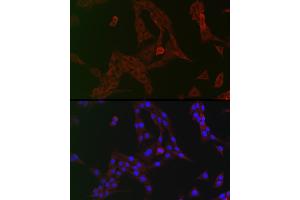 Immunofluorescence analysis of PC-12 cells using GCN2 Rabbit pAb (ABIN6127830, ABIN6140032, ABIN6140034 and ABIN6222976) at dilution of 1:150 (40x lens). (GCN2 Antikörper  (AA 1-300))