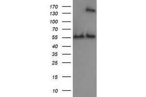 HEK293T cells were transfected with the pCMV6-ENTRY control (Left lane) or pCMV6-ENTRY CAT (Right lane) cDNA for 48 hrs and lysed. (Catalase Antikörper)