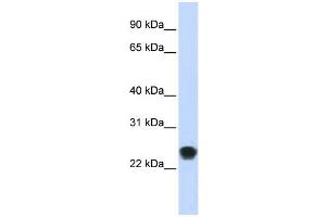 Western Blotting (WB) image for anti-FK506 Binding Protein 11, 19 KDa (FKBP11) antibody (ABIN2459089)