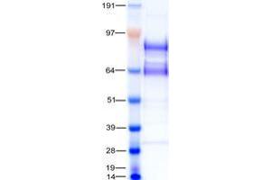 Western Blotting (WB) image for Toll-Like Receptor 5 (TLR5) protein (Myc-DYKDDDDK Tag) (ABIN5505661)
