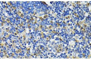 Immunohistochemistry of paraffin-embedded Human appendix using CAMP Polyclonal Antibody at dilution of 1:200 (40x lens). (Cathelicidin Antikörper)