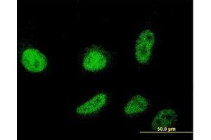 Image no. 2 for anti-Cold Shock Domain Containing C2, RNA Binding (CSDC2) (AA 1-154) antibody (ABIN466198) (CSDC2 Antikörper  (AA 1-154))