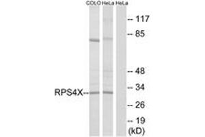 Western blot analysis of extracts from HeLa/COLO cells, using RPS4X Antibody.