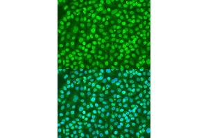 Immunofluorescence analysis of U2OS cells using BDNF antibody (ABIN1871274) at dilution of 1:100. (BDNF Antikörper)