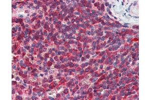 Anti-PIP4K2A / PIP5K2A antibody IHC of human spleen. (PIP4K2A Antikörper  (AA 304-366))
