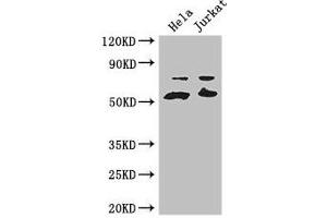 Western Blot Positive WB detected in: Hela whole cell lysate, Jurkat whole cell lysate All lanes: YES1 antibody at 3. (YES1 Antikörper  (AA 1-155))