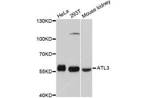 Western blot analysis of extracts of various cell lines, using ATL3 antibody (ABIN5997276) at 1/1000 dilution. (ATL3 Antikörper)