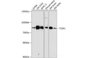 Western blot analysis of extracts of various cell lines using F13A1 Polyclonal Antibody at dilution of 1:3000. (F13A1 Antikörper)