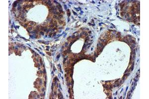 Immunohistochemical staining of paraffin-embedded Human breast tissue using anti-TUBAL3 mouse monoclonal antibody. (TUBAL3 Antikörper  (AA 150-446))