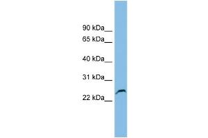 WB Suggested Anti-GSTK1 Antibody Titration: 0. (GSTK1 Antikörper  (Middle Region))