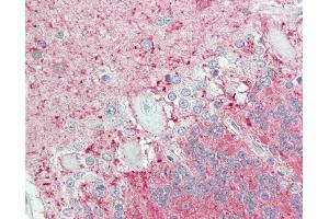 Immunohistochemistry (IHC) image for anti-Endothelin Receptor Type B (EDNRB) (AA 409-439) antibody (ABIN2599521)